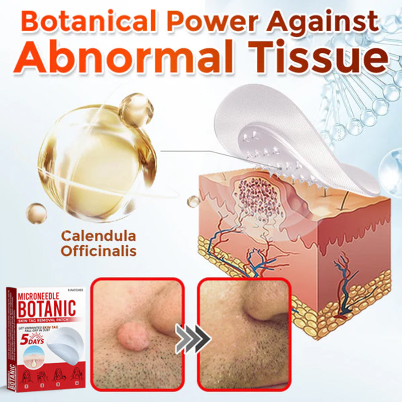 Removal Patch | Removes Moles, Warts, Skin Flaws & Pigmentation