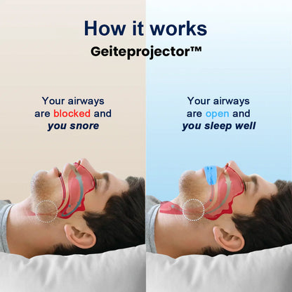 waresluck - Anti-SnoringMouthpiece Universal Size