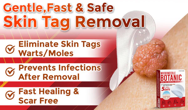 Removal Patch | Removes Moles, Warts, Skin Flaws & Pigmentation