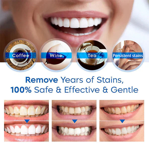 Waresluck™ Teeth Whitening Pen