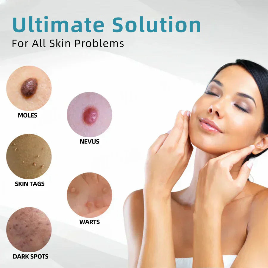 ✨All-in-One CO₂ Laser Eraser Pen | Removes Moles, Warts, Skin Flaws & Pigmentation