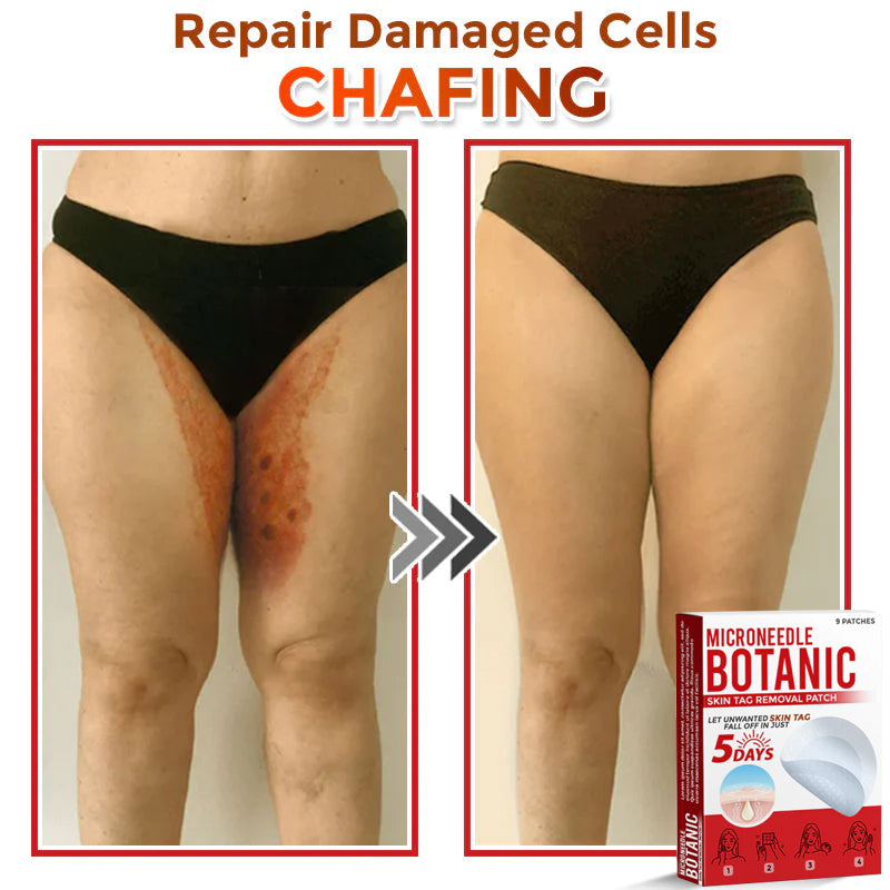 Removal Patch | Removes Moles, Warts, Skin Flaws & Pigmentation