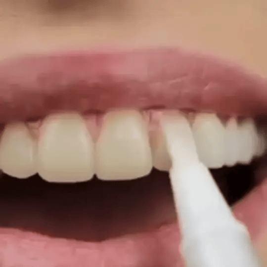 Waresluck™ Teeth Whitening Pen