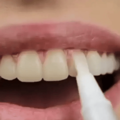 Waresluck™ Teeth Whitening Pen