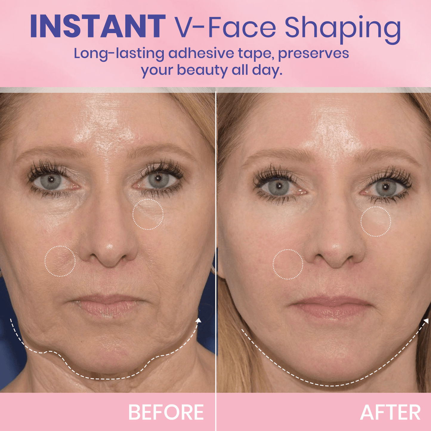 💖🎁Last Day 50% OFF-Aweiya ™ V-Face Lifting Invisible Adhesive Tape