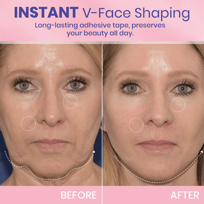 💖🎁Last Day 50% OFF-Aweiya ™ V-Face Lifting Invisible Adhesive Tape