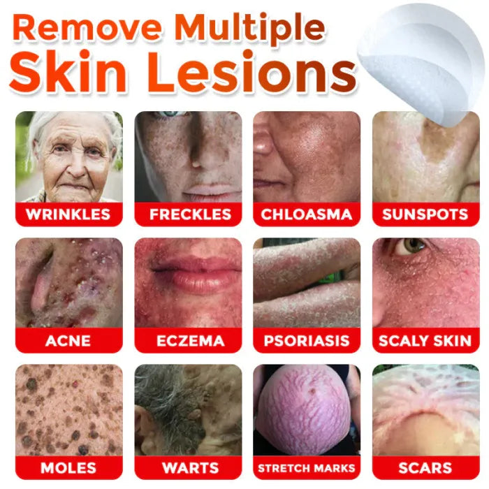 Removal Patch | Removes Moles, Warts, Skin Flaws & Pigmentation